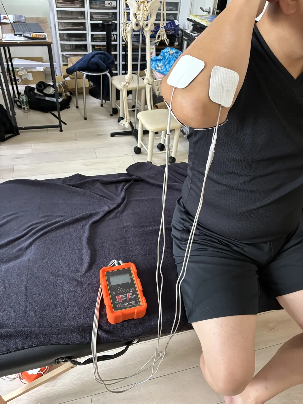 腕と肘の周囲にMAXBODYの電極パッドを貼った様子